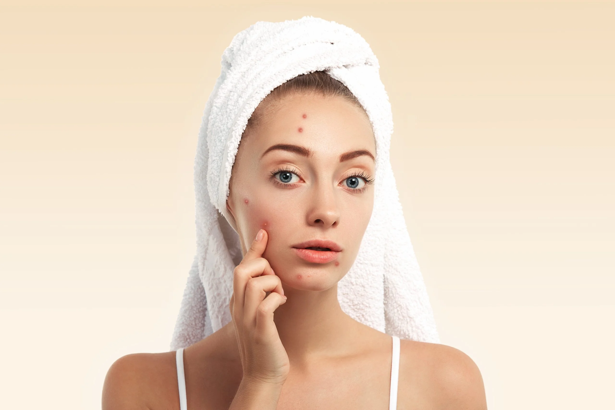 Pimple Treatment Bella Soul Clinic