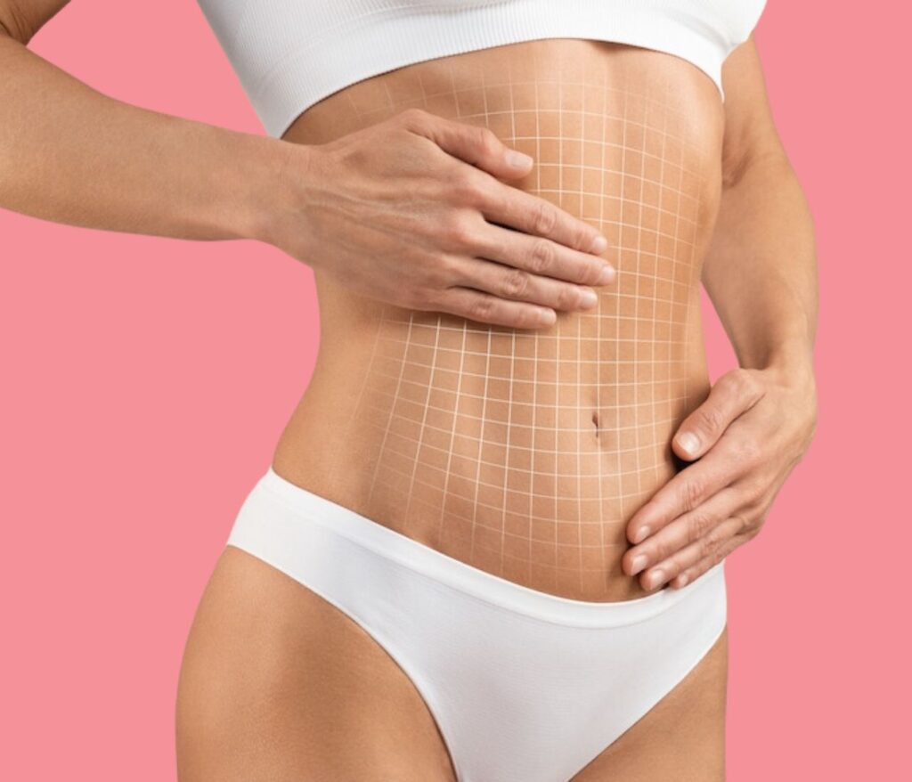 Tummy Tuck Consultation Bella Soul Clinic